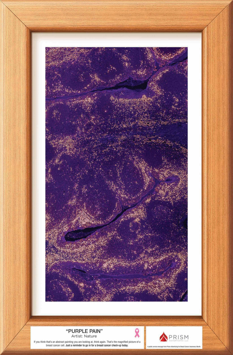 廣告公司為乳腺癌體檢檢測公益宣傳月設計的抽象藝術風創意海報賞析-紫色的痛苦
