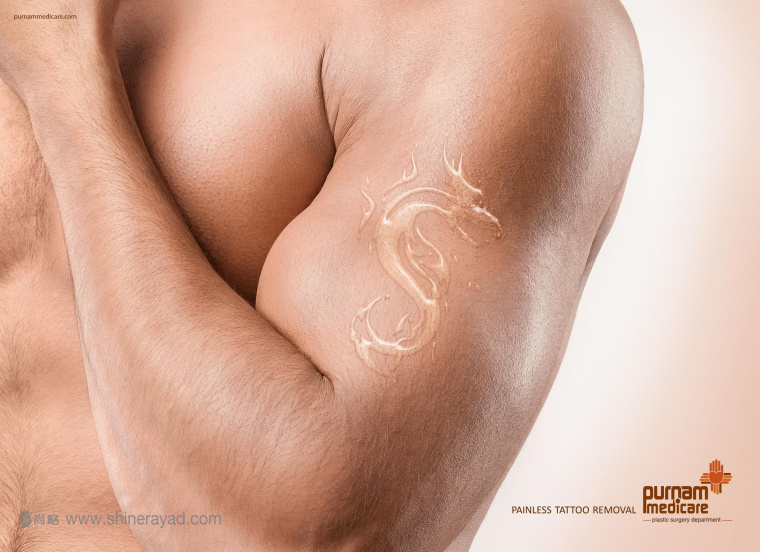 “紋身 - 龍”篇無痛紋身去除醫(yī)療服務(wù)平面創(chuàng)意廣告設(shè)計(jì)-上海設(shè)計(jì)公司