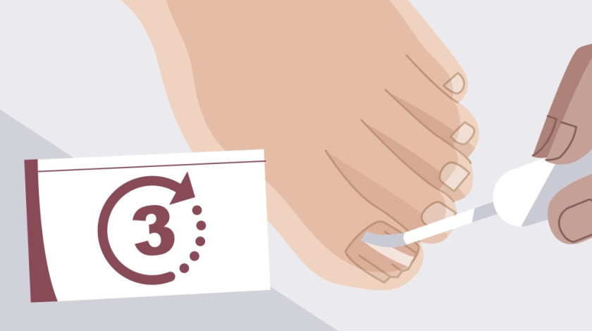 Nailner美甲修復劑真菌指甲治療藥品TVC二維動畫廣告策劃“7天見效”